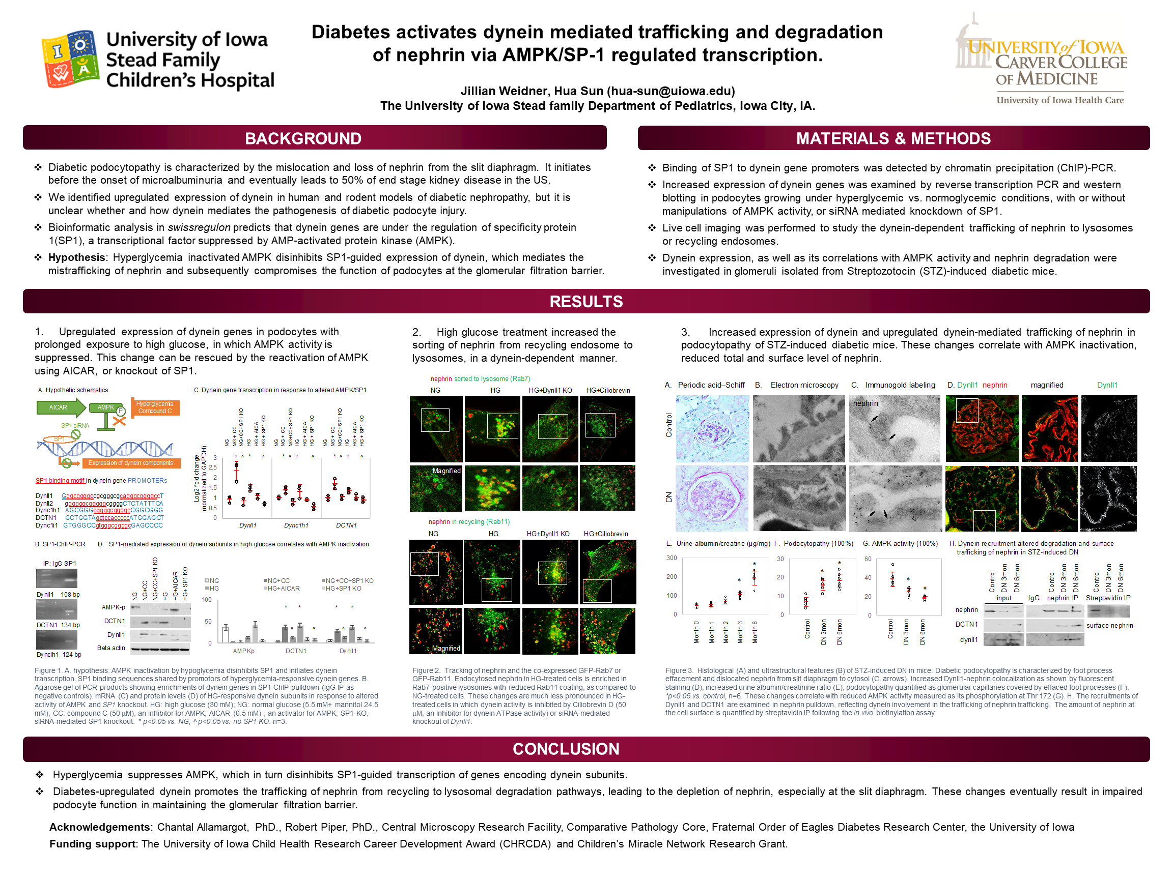 db activates dynein mediated trafficking/degradation of nephrin via AMPK/SP-1